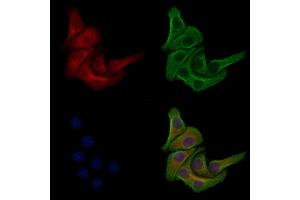 Phospho-PI3K p85 beta (Ser605) Antibody staining Hela cells(heat shock treatment) by IF/ICC.