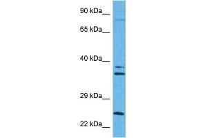 Host:  Rabbit  Target Name:  CPT1A  Sample Tissue:  Human MDA-MB-435s Whole Cell  Antibody Dilution:  1ug/ml (CPT1A antibody  (Middle Region))