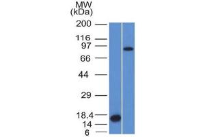 Western blot testing of 1) partial human recombinant protein and 2) human HeLa lysate with Factor XIIIa antibody (clone F13A1/1448).