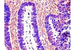 Immunohistochemistry (IHC) image for anti-Cathepsin B (CTSB) (AA 82-333) antibody (ABIN7146996)