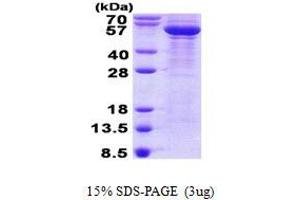 Image no. 1 for Tubulin, beta 3 (TUBB3) protein (His tag) (ABIN1098562)