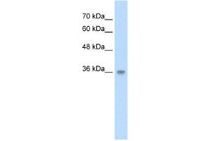 WB Suggested Anti-PP2447 Antibody Titration:  2. (TRABD antibody  (N-Term))