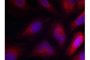 Immunofluorescence staining of methanol-fixed Hela cells using MARCKS(Phospho-Ser162) Antibody. (MARCKS antibody  (pSer162))