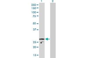 Western Blot analysis of KCNIP2 expression in transfected 293T cell line by KCNIP2 MaxPab polyclonal antibody. (KCNIP2 antibody  (AA 1-270))