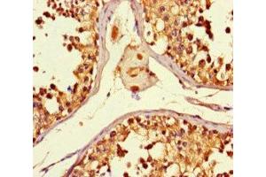 Immunohistochemistry of paraffin-embedded human testis tissue using ABIN7160774 at dilution of 1:100 (SMYD2A antibody  (AA 115-272))
