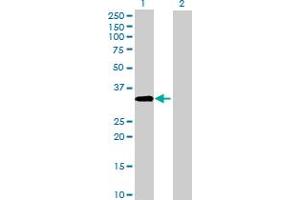 Western Blot analysis of ACBD4 expression in transfected 293T cell line by ACBD4 MaxPab polyclonal antibody. (ACBD4 antibody  (AA 1-305))