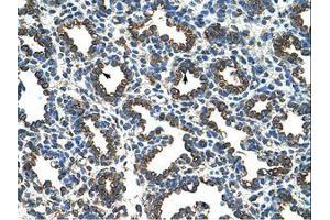 Image no. 1 for anti-Ribosomal Protein L8 (RPL8) (AA 155-204) antibody (ABIN203299) (RPL8 antibody  (AA 155-204))