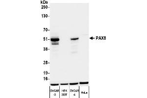 Western Blotting (WB) image for anti-Paired Box 8 (PAX8) (AA 225-275) antibody (ABIN7795777) (Recombinant PAX8 antibody  (AA 225-275))