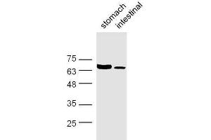 Mouse stomach and intestine lysates probed with Rabbit Anti-GABA Transporter 3/GAT 3 Polyclonal Antibody, Unconjugated  at 1:500 for 90 min at 37˚C. (SLC6A11 antibody  (AA 531-632))