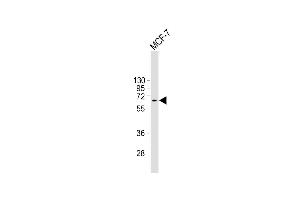 Anti-MDM2 Antibody at 1:4000 dilution + MCF-7 whole cell lysate Lysates/proteins at 20 μg per lane. (MDM2 antibody  (AA 196-435))