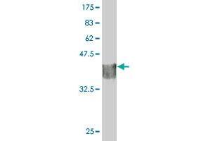 Western Blot detection against Immunogen (35. (STK40 antibody  (AA 349-434))