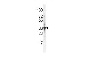Western blot analysis of LDLR Antibody (C-term) (ABIN392554 and ABIN2842101) in NCI- cell line lysates (35 μg/lane). (LDLRAP1 antibody  (C-Term))