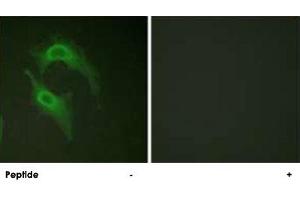 Immunofluorescence analysis of HeLa cells, using CD226 polyclonal antibody . (CD226 antibody  (Ser329))