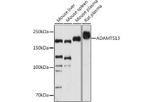 Western blot analysis of extracts of various cell lines, using  antibody (ABIN7265440) at 1:1000 dilution. (ADAMTS13 antibody)