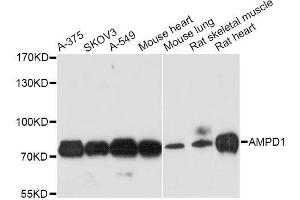 Western blot analysis of extracts of various cell lines, using AMPD1 antibody. (AMPD1 antibody  (AA 50-260))