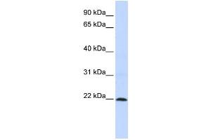Western Blotting (WB) image for anti-Zinc Finger Protein 581 (ZNF581) antibody (ABIN2458276) (ZNF581 antibody)