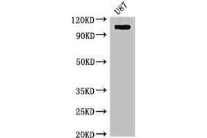 Western Blot Positive WB detected in: U87 whole cell lysate All lanes: HK2 antibody at 4 μg/mL Secondary Goat polyclonal to rabbit IgG at 1/50000 dilution Predicted band size: 103 kDa Observed band size: 103 kDa (Hexokinase 2 antibody  (AA 334-526))