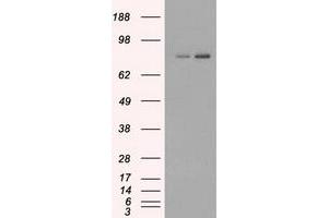 HEK293T cells were transfected with the pCMV6-ENTRY control (Left lane) or pCMV6-ENTRY FERMT2 (Right lane) cDNA for 48 hrs and lysed. (FERMT2 antibody)