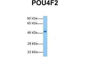 Host:  Rabbit  Target Name:  POU4F2  Sample Tissue:  Human Fetal Liver  Antibody Dilution:  1. (POU4F2 antibody  (N-Term))