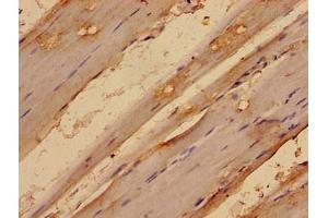 Immunohistochemistry analysis of human skeletal muscle tissue using ABIN7159132 at dilution of 1:100 (MED24 antibody  (AA 1-300))