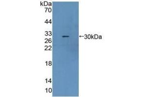 Detection of Recombinant CBR1, Mouse using Polyclonal Antibody to Carbonyl Reductase 1 (CBR1)