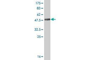 Western Blot detection against Immunogen (45. (Stathmin 3 antibody  (AA 1-180))