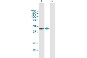 Western Blot analysis of MICB expression in transfected 293T cell line by MICB MaxPab polyclonal antibody.