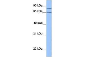 OXCT2 antibody used at 1 ug/ml to detect target protein. (OXCT2 antibody  (Middle Region))