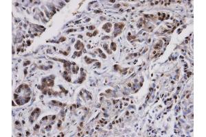 Immunohistochemistry (IHC) image for anti-Protein Phosphatase 2, Catalytic Subunit, alpha Isozyme (PPP2CA) (C-Term) antibody (ABIN2856333)