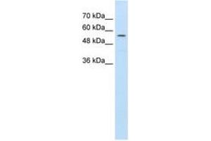 Image no. 1 for anti-ATP-Binding Cassette, Sub-Family D (Ald), Member 4 (ABCD4) (AA 451-500) antibody (ABIN396878) (ABCD4 antibody  (AA 451-500))