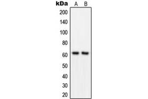 Western blot analysis of GRB14 expression in MOLT4 (A), COLO205 (B) whole cell lysates. (GRB14 antibody  (Center))