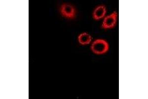 Immunofluorescent analysis of SerpinB1 staining in Hela cells. (SERPINB1 antibody)