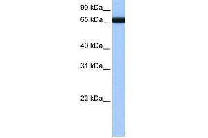 WB Suggested Anti-HNRPLL Antibody Titration:  0. (HNRPLL antibody  (N-Term))