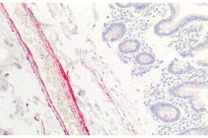 Detection of COL8a1 in Human Small intestine Tissue using Polyclonal Antibody to Collagen Type VIII Alpha 1 (COL8a1) (COL8A1 antibody  (AA 583-743))