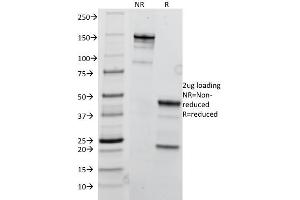 SDS-PAGE Analysis Purified TRIM29 Mouse Monoclonal Antibody (TRIM29/1041). (TRIM29 antibody  (AA 1-200))