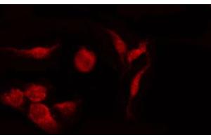 ABIN6274361 staining Hela by IF/ICC. (CDK5R1 antibody  (N-Term))