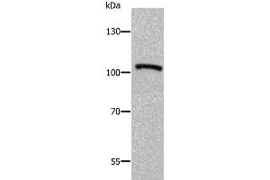Western Blotting (WB) image for anti-ADAM Metallopeptidase with thrombospondin Type 1 Motif, 5 (ADAMTS5) antibody (ABIN2425574) (ADAMTS5 antibody)