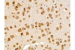 anti-serologically Defined Colon Cancer Antigen 3 (SDCCAG3) (N-Term) antibody