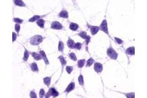 Anti-GRM3 / MGLUR3 antibody immunocytochemistry (ICC) staining of untransfected HEK293 human embryonic kidney cells. (Metabotropic Glutamate Receptor 3 antibody  (N-Term))