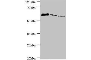 Western blot All lanes: Tyrosyl-DNA phosphodiesterase 1 antibody at 8 μg/mL Lane 1: MCF-7 whole cell lysate Lane 2: Mouse lung tissue Lane 3: Rat brain tissue Secondary Goat polyclonal to rabbit IgG at 1/10000 dilution Predicted band size: 69, 42 kDa Observed band size: 69 kDa