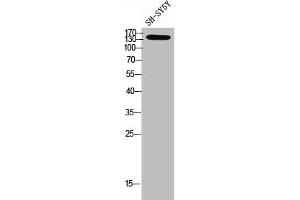 Western Blot analysis of SH-SY5Y cells using NTE Polyclonal Antibody (PNPLA6 antibody  (N-Term))