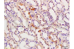 Formalin-fixed and paraffin embedded rat kidney labeled with Rabbit Anti S100A4 Polyclonal Antibody, Unconjugated (ABIN703706) at 1:200 followed by conjugation to the secondary antibody and DAB staining (s100a4 antibody  (AA 15-101))