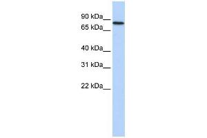 Human Heart; WB Suggested Anti-ADARB2 Antibody Titration: 0. (ADARB2 antibody  (Middle Region))