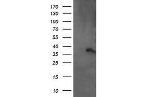 Image no. 6 for anti-Armadillo Repeat Containing 1 (ARMC1) antibody (ABIN1496727) (ARMC1 antibody)