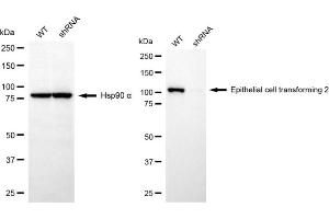 Western blotting analysis using epithelial cell transforming 2 antibody (ABIN7798482). (ECT2 antibody)