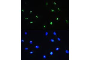 Immunofluorescence analysis of H9C2 cells using NOP58 Rabbit pAb (ABIN1681073, ABIN3019190, ABIN3019191 and ABIN6220753) at dilution of 1:100. (NOP58 antibody  (AA 360-529))