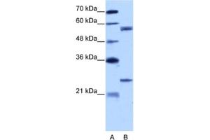 Western Blotting (WB) image for anti-Copine I (CPNE1) antibody (ABIN2462160) (CPNE1 antibody)