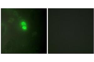 Immunofluorescence analysis of HeLa cells, using Dyskerin antibody.