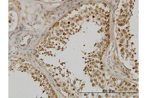 Immunoperoxidase of monoclonal antibody to DDX3Y on formalin-fixed paraffin-embedded human testis. (DDX3Y antibody  (AA 1-80))