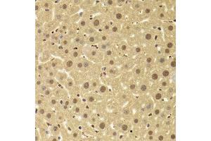 Immunohistochemistry (Paraffin-embedded Sections) (IHC (p)) image for anti-Acidic (Leucine-Rich) Nuclear phosphoprotein 32 Family, Member A (ANP32A) (AA 1-170) antibody (ABIN6136909)